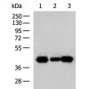 兔抗SH3GL2多克隆抗体