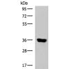 兔抗KCNK15多克隆抗体