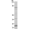兔抗PLA2G4C多克隆抗体