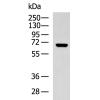 兔抗KCNN2多克隆抗体
