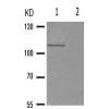 兔抗SIRT1(Phospho-Ser47) 多克隆抗体