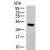 兔抗KCTD7多克隆抗体