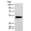 兔抗KCTD16多克隆抗体