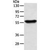 兔抗SLC1A3多克隆抗体