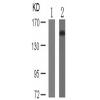 兔抗PLCG2 (Phospho-Tyr753) 多克隆抗体