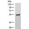 兔抗KDM4D多克隆抗体 