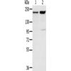兔抗KDM5A多克隆抗体