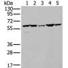 兔抗ZBTB3多克隆抗体 
