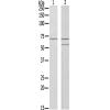 兔抗SLC7A4多克隆抗体