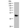 兔抗KIR2DL5A多克隆抗体