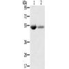 兔抗SLC13A3多克隆抗体 