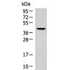 兔抗KLF6多克隆抗体