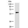 兔抗SLC22A12多克隆抗体