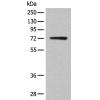 兔抗KLHL36多克隆抗体 