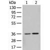 兔抗SLC25A27多克隆抗体