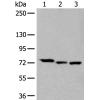 兔抗SLC27A4多克隆抗体