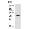 兔抗KLK12多克隆抗体