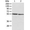 兔抗SLC29A1多克隆抗体 