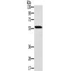 兔抗SLC29A4多克隆抗体