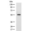 兔抗SLC39A5多克隆抗体