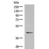 兔抗KRR1多克隆抗体