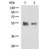 兔抗KRT12多克隆抗体