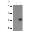 兔抗KRT18 (Phospho-Ser33)多克隆抗体