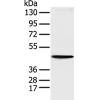兔抗KRT18多克隆抗体