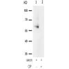 兔抗PRKAA1 PRKAA2(Phospho-Thr183 Thr172)多克隆抗体 