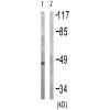 兔抗PRKAR2B(Phospho-Ser113) 多克隆抗体  