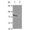 兔抗PRKCB(Phospho-Ser661) 多克隆抗体