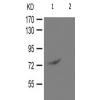 兔抗PRKCD(Phospho-Tyr313) 多克隆抗体