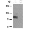 兔抗PRKCZ(Phospho-Thr560) 多克隆抗体