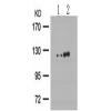 兔抗PRKD1 (Phospho-Ser738) 多克隆抗体