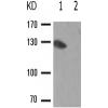 兔抗PRKD1(Phospho-Tyr463) 多克隆抗体