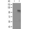 兔抗PRKD123(Phospho-Ser738742) 多克隆抗体