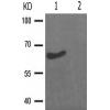兔抗SMAD2(Phospho-Ser250) 多克隆抗体