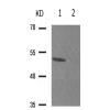 兔抗SMAD3(Phospho-Thr179) 多克隆抗体