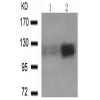 兔抗PTK2 (phospho-Tyr576 Tyr577)多克隆抗体