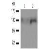 兔抗PTK2 (Phospho-Tyr861) 多克隆抗体