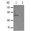 兔抗PTK2(Phospho-Ser843) 多克隆抗体