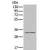 兔抗ZNF346多克隆抗体   