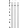 兔抗KSR2多克隆抗体 