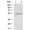 兔抗ZNF672多克隆抗体