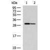 兔抗ZNF688多克隆抗体    