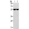 兔抗TRIM62多克隆抗体