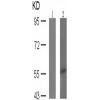 兔抗LCK (phospho-Tyr505)多克隆抗体 