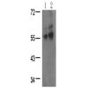兔抗LCK (Phospho-Tyr394)多克隆抗体 