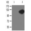 兔抗LIPE(Phospho-Ser552) 多克隆抗体 
