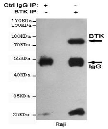 小鼠抗BTK单克隆抗体   